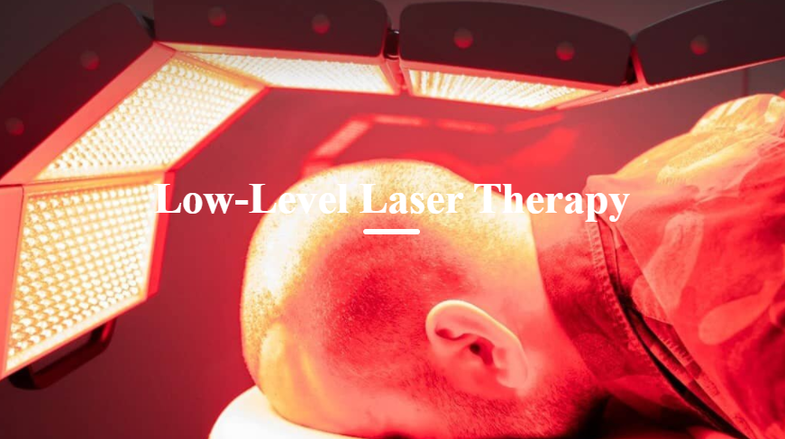 low level laser therapy hair transplant