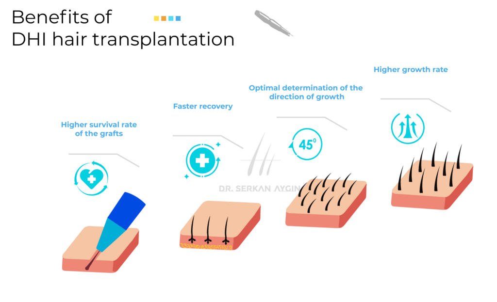DHI Hair transplantation_benefits