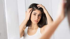 dry scalp hair loss