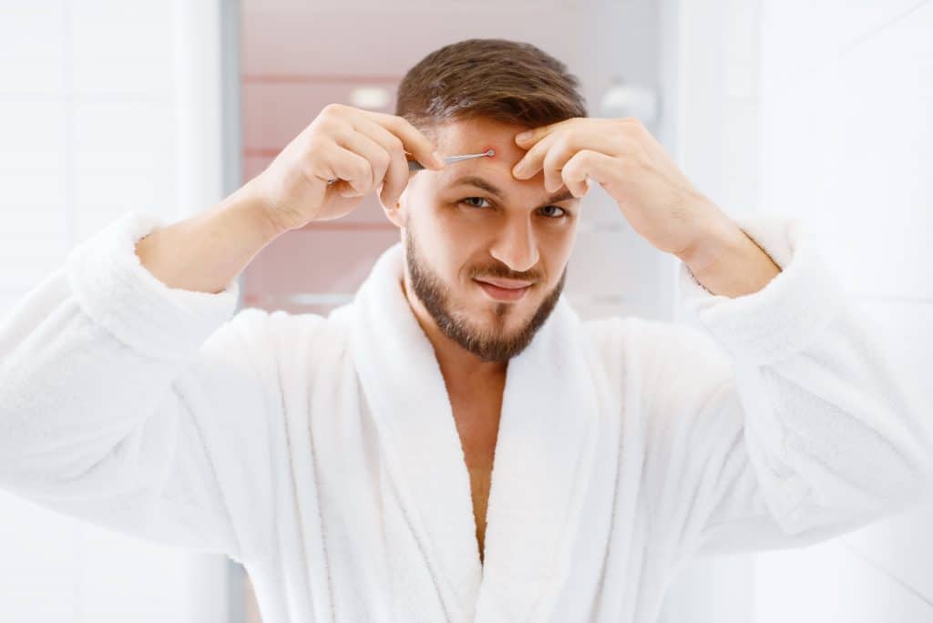 What To Do For Pimples After A Hair Transplant?