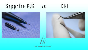 Sapphire FUE vs DHI
