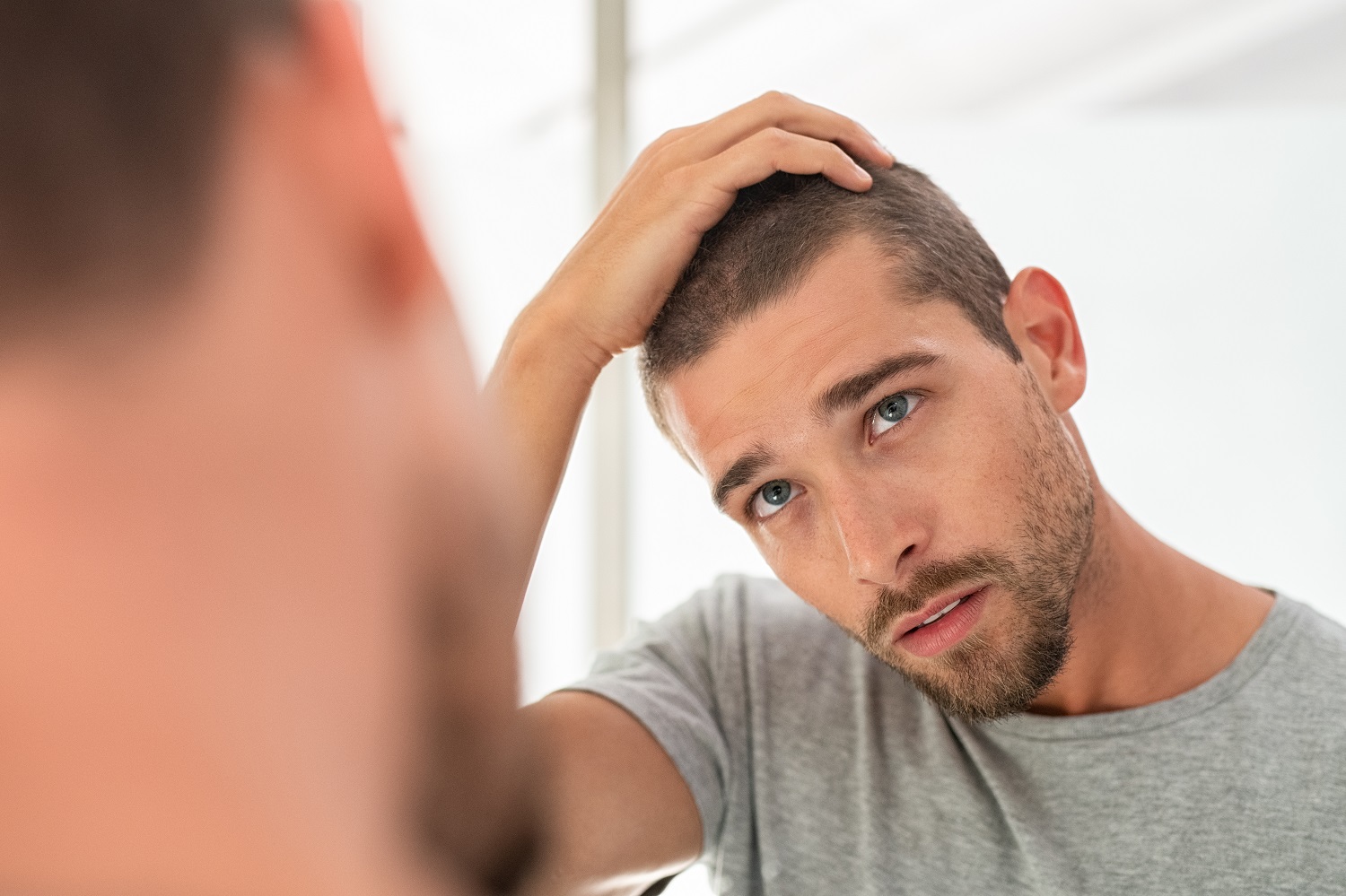 Hairline Surgery vs Hair Transplant: Which is Right for You?