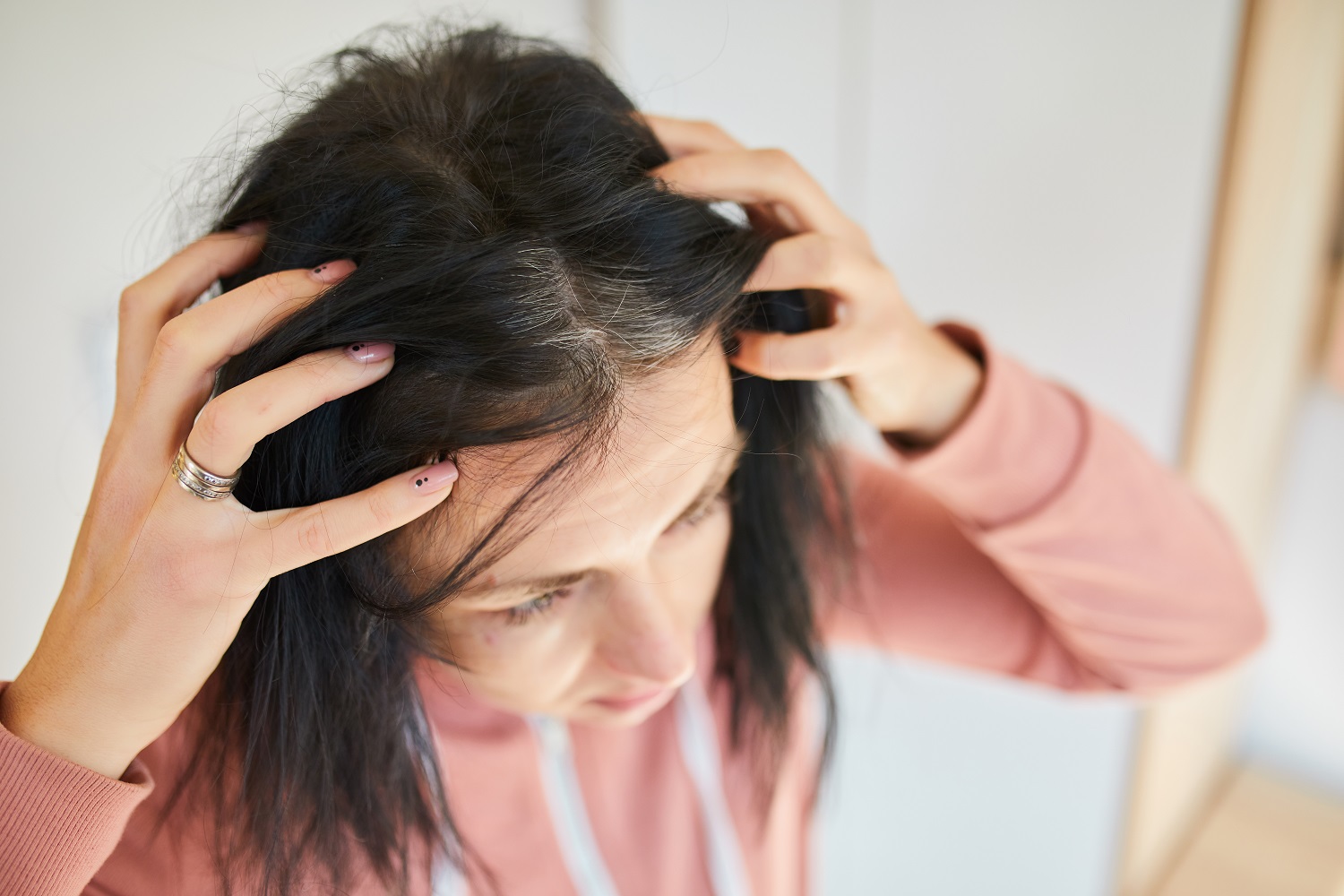 Fungal Infection Hair Loss