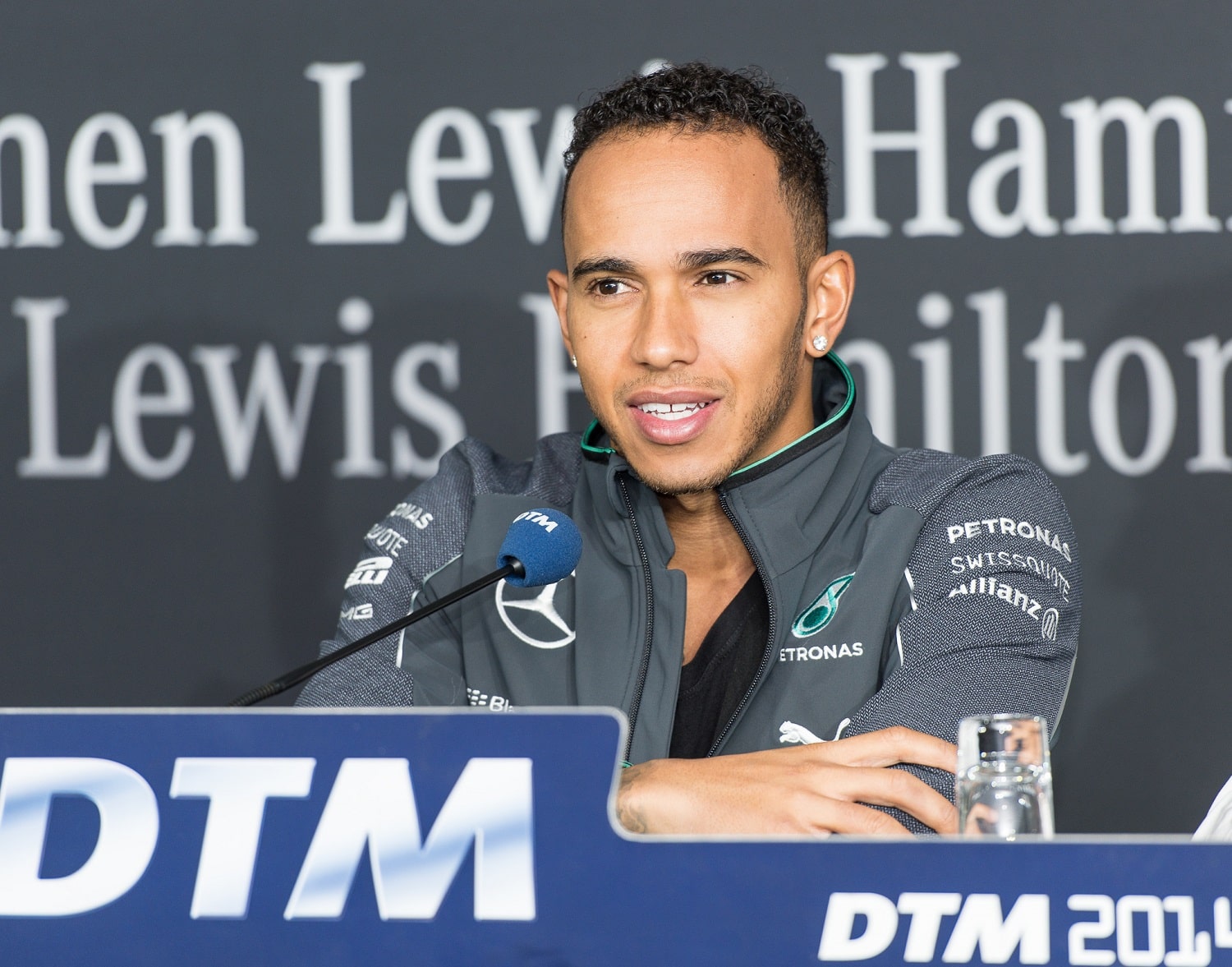 Did Lewis Hamilton Have a Hair Transplant?